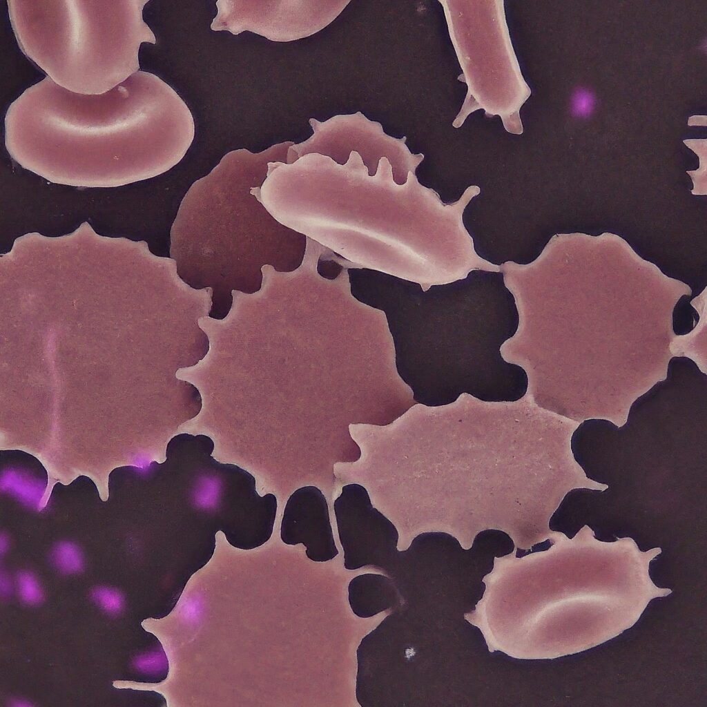 Platelets, also known as thrombocytes, are created in the bone marrow and circulate through the bloodstream. They are vital in hemostasis, which is the process of halting bleeding when blood vessels are injured. Platelets cervical this by creating clots at the site of injury, so avoiding excessive bleeding